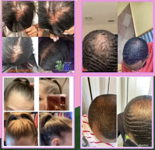 MK Organic Hair Drops 